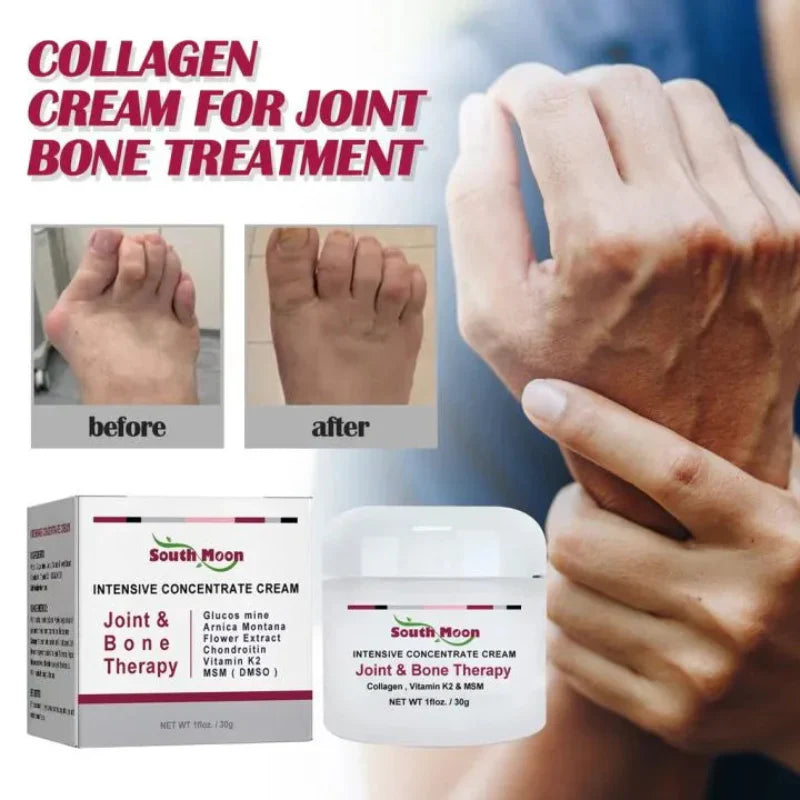 🦴✨ South Moon Intensive Concentrate Cream – Joint & Bone Therapy 🦴✨ ( BUY 1 GET 1 FREE )