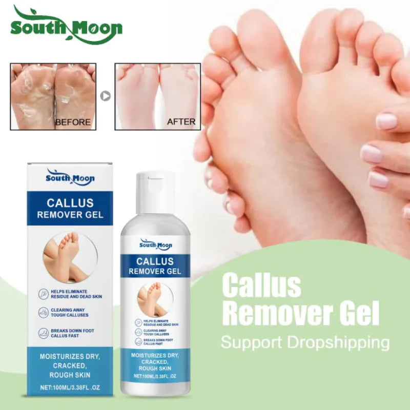 ✨ South Moon Foot Callus Remover Gel ✨ ( BUY 1 GET 1 FREE )