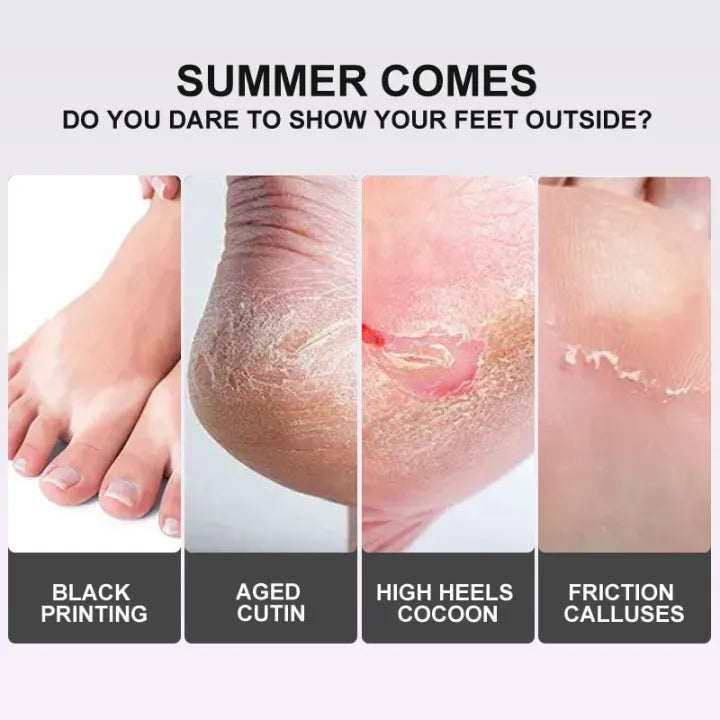 EXFOLIATING FOOT PEEL MASK ( BUY 1 GET 1 FREE )