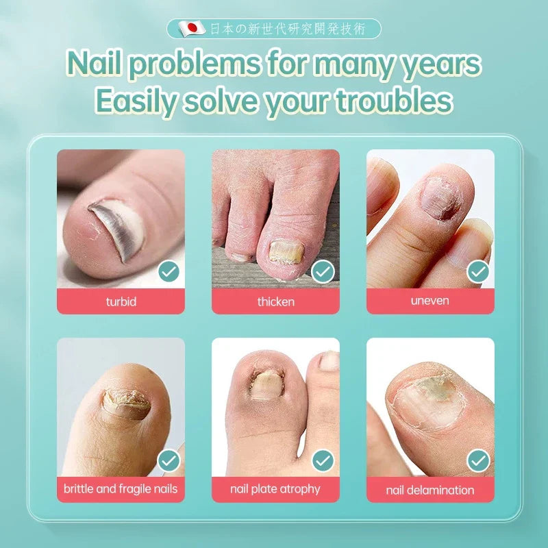 Dr.ville Nail Fungus Treatment Spray