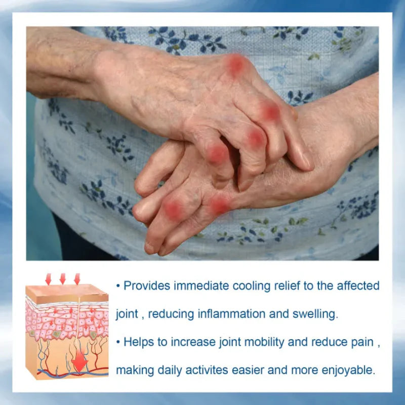 ✨ South Moon Joint Pain Relief Serum ✨ ( BUY 1 GET 1 FREE )